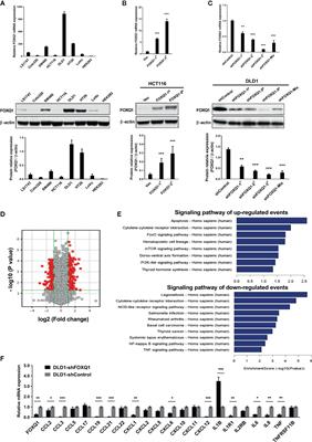 Forkhead Box Q1 Is Critical to Angiogenesis and Macrophage Recruitment of Colorectal Cancer